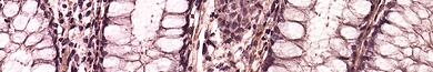 Pharmacokinetic Considerations of Biosimilars